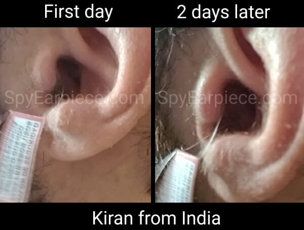 Spy earpiece exam cheating Kiran from India